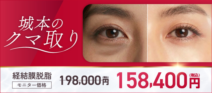 城本のクマ取り