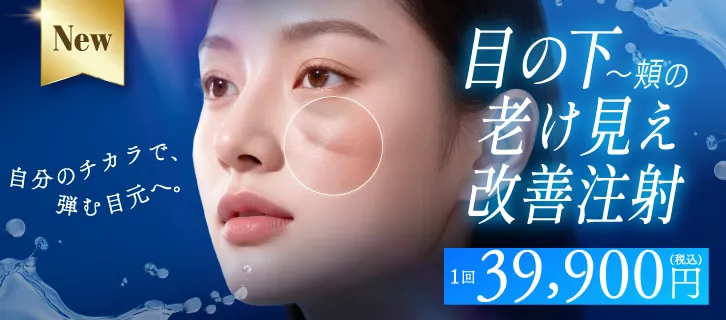 目の下～頬の老け見え改善注射