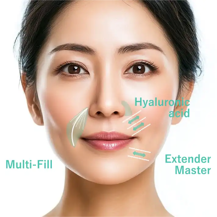 段差にアプローチする段差(ダンチャ)