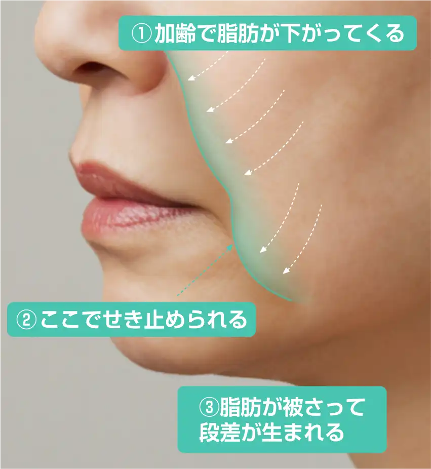 なぜ段差（ダンチャ）ができるの？