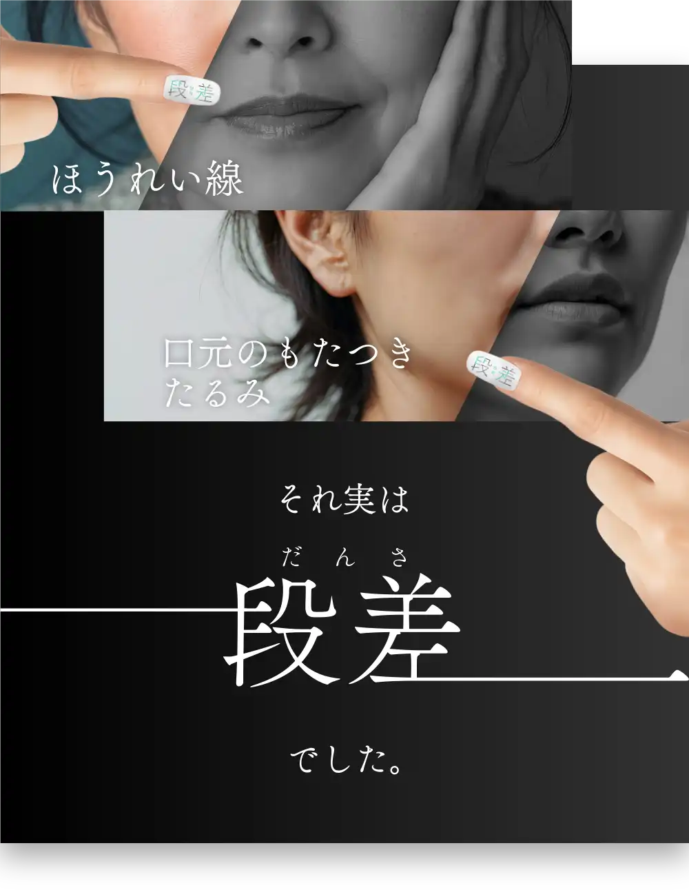 ほうれい線、口元のもたつき・たるみ　それ実は段差でした