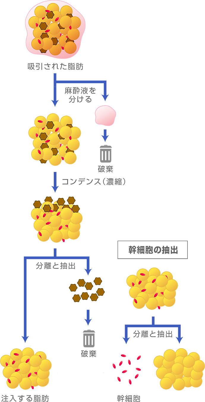 マイクロCRF