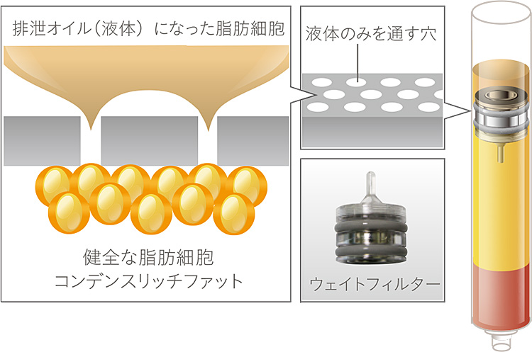 フィルタリング技術