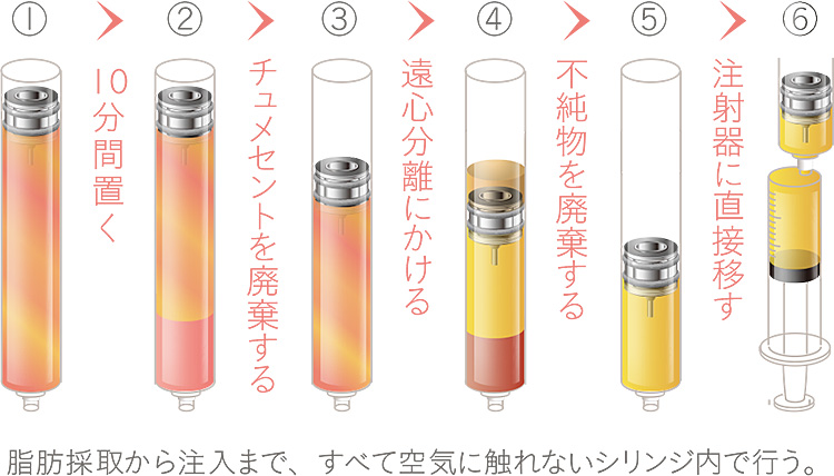 空気に触れないプロセス