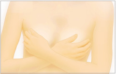 人工乳腺の歴史