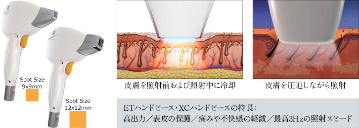 ライトシェア ETハンドピース / XCハンドピース