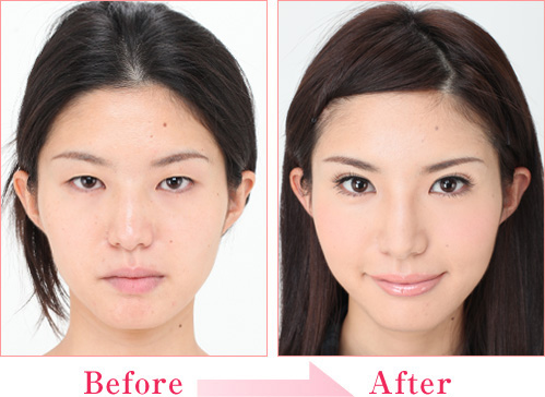 上原かな さん 私も綺麗になりました 二重まぶた 目の整形なら城本クリニック 上原かな さん 私も綺麗になりました 二重まぶた 目の整形なら城本クリニック