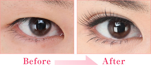 上原かな さん 私も綺麗になりました 二重まぶた 目の整形なら城本クリニック 上原かな さん 私も綺麗になりました 二重まぶた 目の整形なら城本クリニック