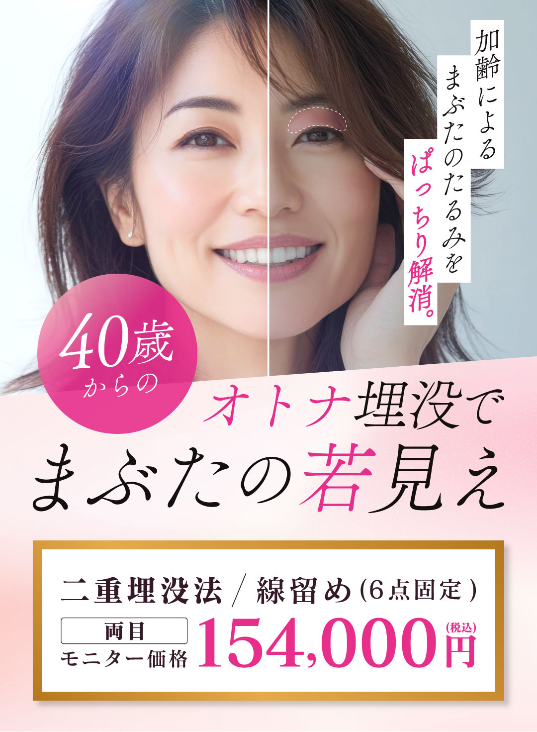 オトナ埋没