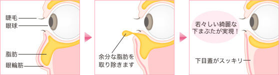 若々しい綺麗な下まぶたが実現！