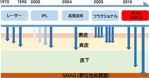 テクノロジーの進化