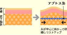 アプトスの技術紹介