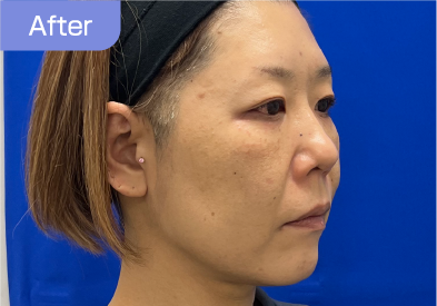 40代after