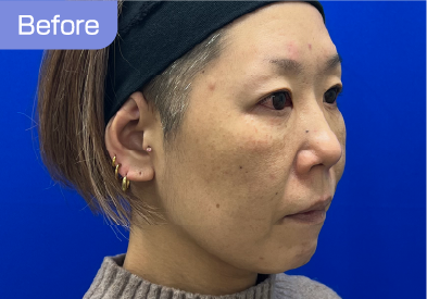 40代before