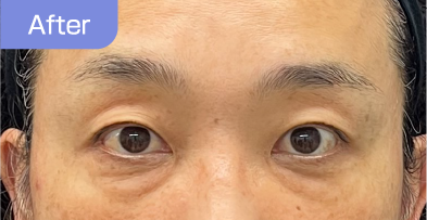 50代after