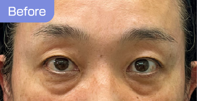 50代before