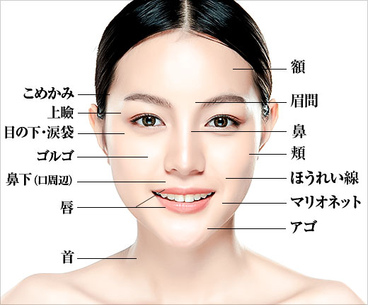 ヒアルロン酸 顔の注入部位