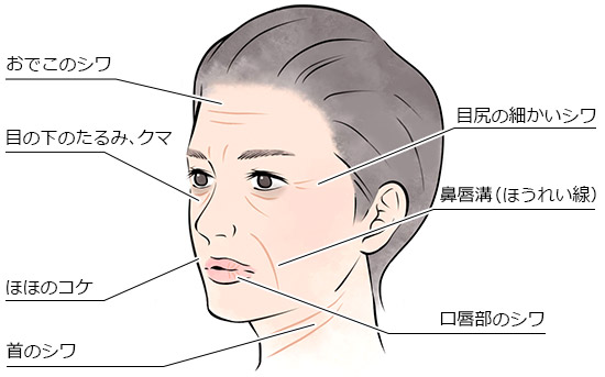 ヒアルロン酸の効果的な注射箇所