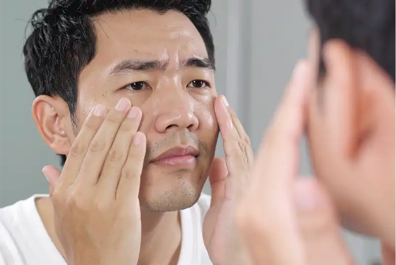 目の下のクマ・たるみ