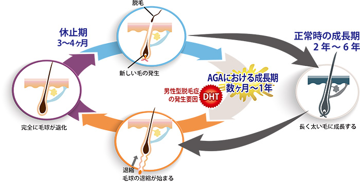 AGAサイクル