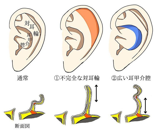 立ち耳とは