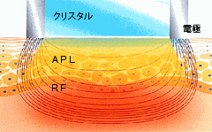 フォトRFのメカニズム