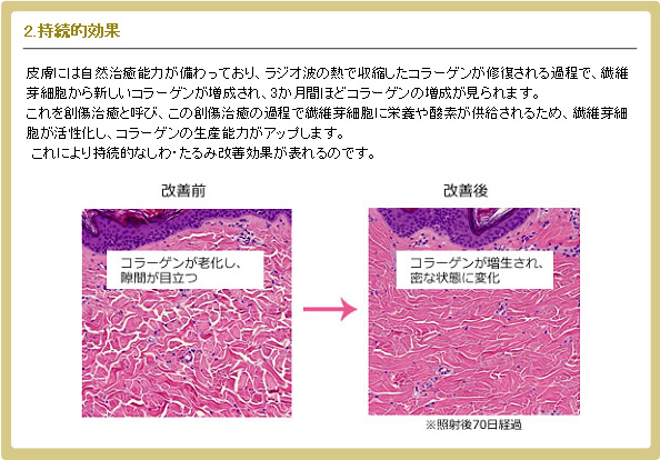 2.持続的効果