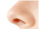 隆鼻術・鼻