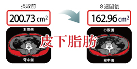 皮下脂肪の低減