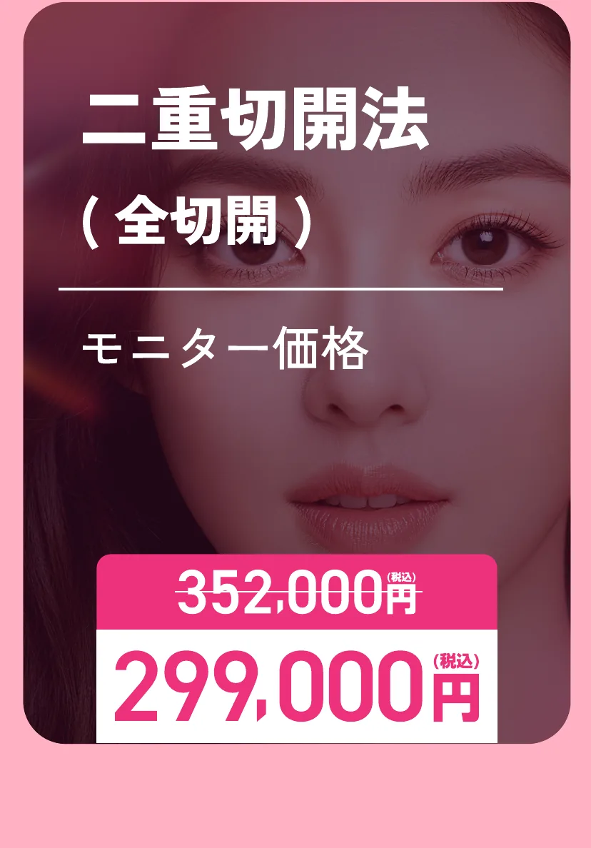 二重切開法(全切開)モニター価格 通常352,000円が299,000円(税込)