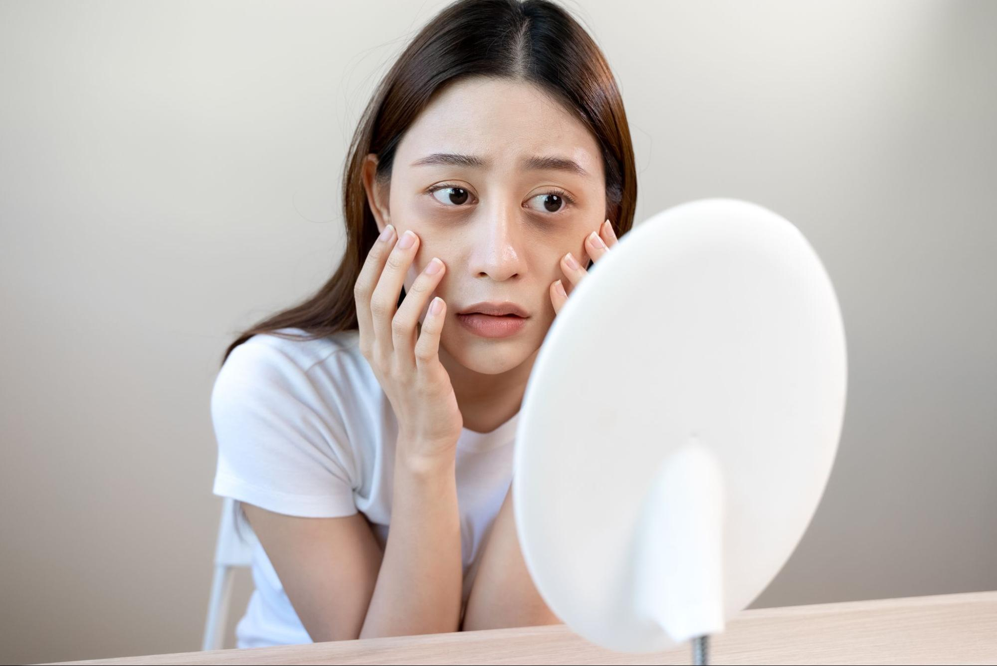 【目の下のクマ】種類や原因、治療方法｜原因に合わせた治療を受けるのが大切な理由とは