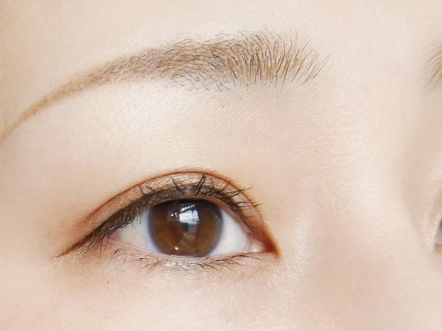 城本クリニックの二重埋没法の特徴