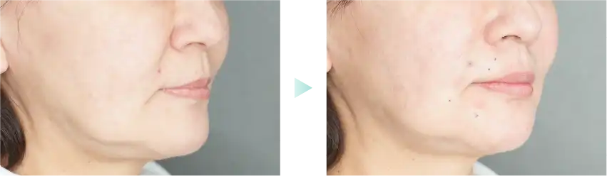 症例写真3