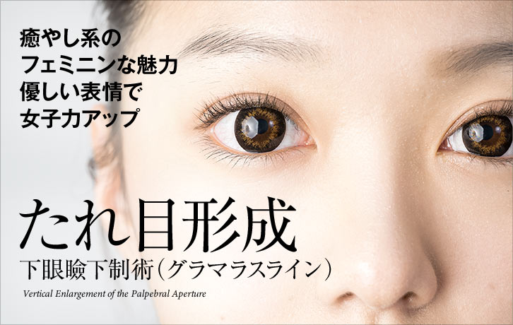 たれ目形成(下眼瞼下制)