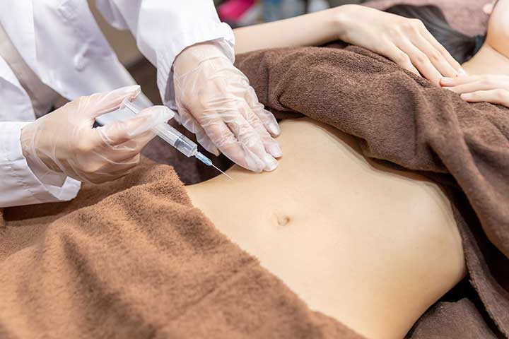脂肪溶解注射とは