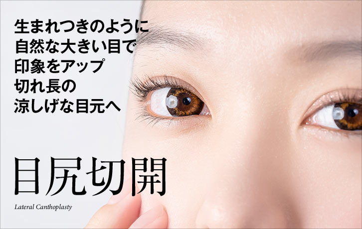 目尻切開法