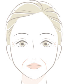 表情じわ