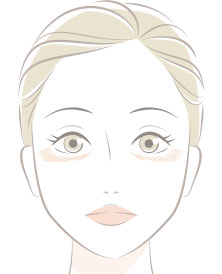 ちりめんじわ