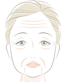 たるみじわ