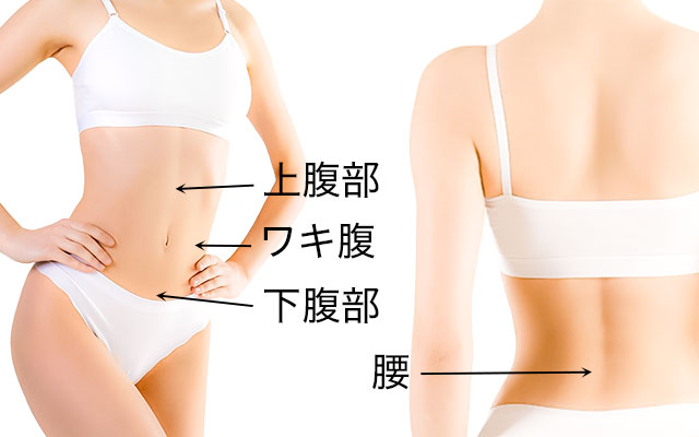 お腹の脂肪吸引の部位別(腰、上腹部、下腹部、ウエスト)解説