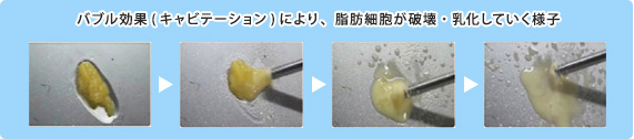 脂肪細胞が破壊、乳化していく様子