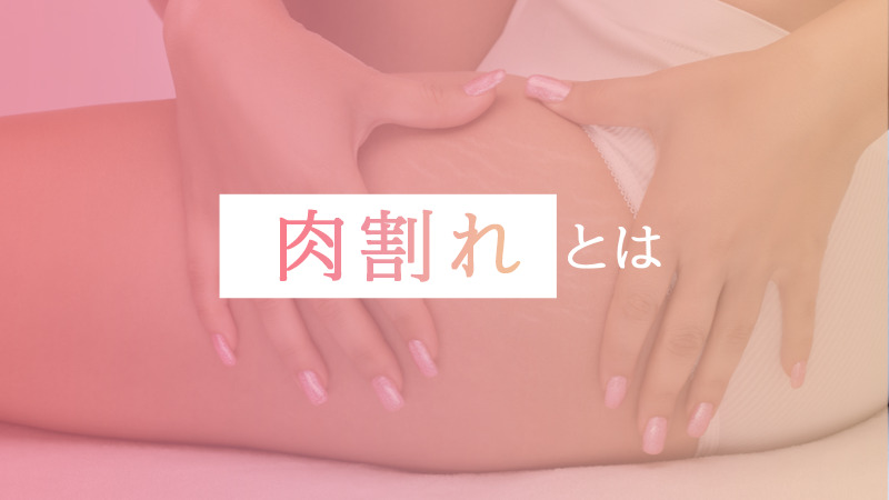 肉割れとは