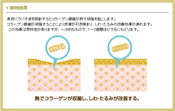 速攻効果のイラスト解説