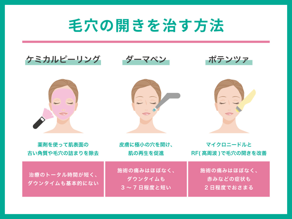 毛穴の開き(開き毛穴)とは