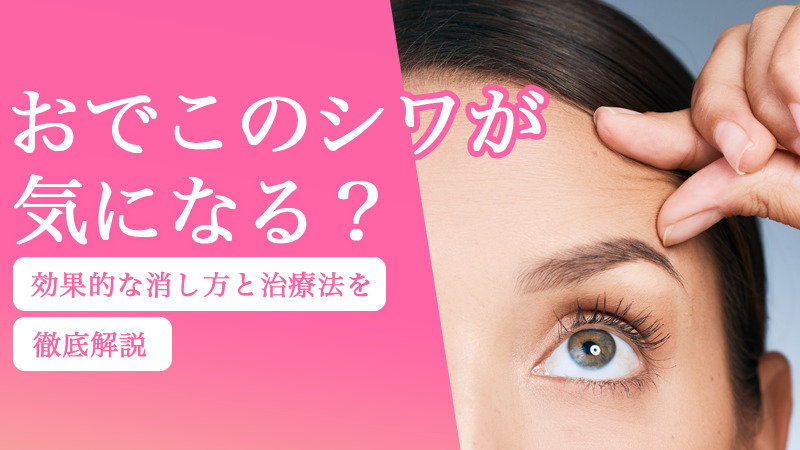 おでこのシワが気になる？効果的な消し方と治療法を徹底解説