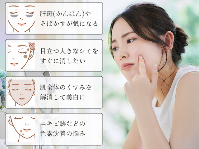 シミ治療はこんな方におすすめ