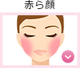 【悩み・症状から探す】赤ら顔