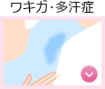 【悩み・症状から探す】ワキガ・多汗症