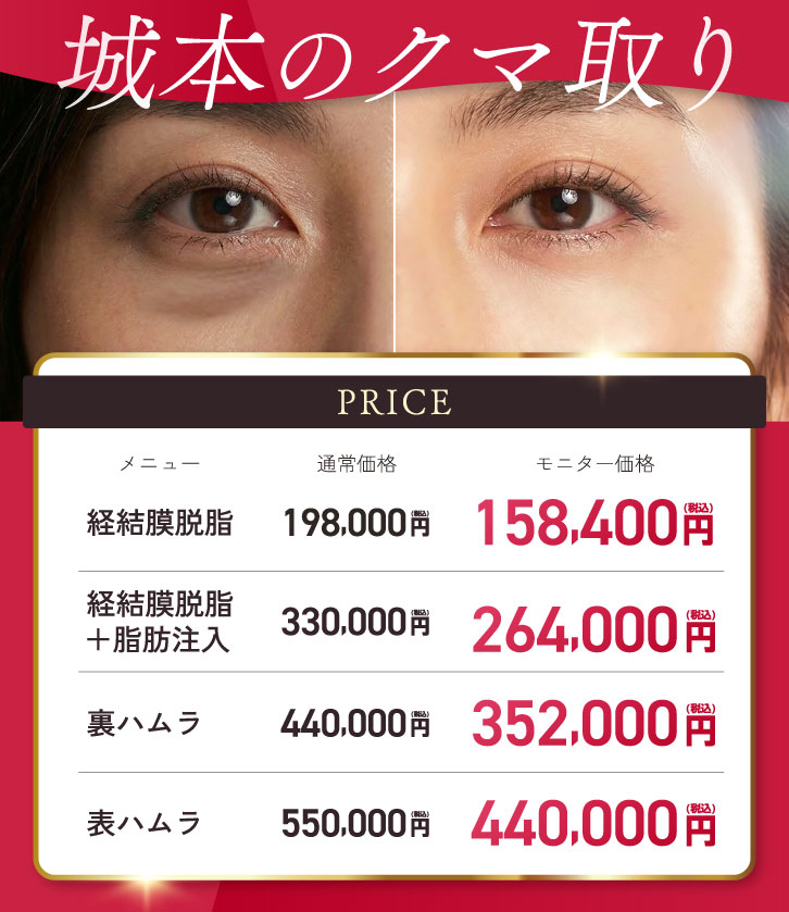 城本クリニックのクマ取り
