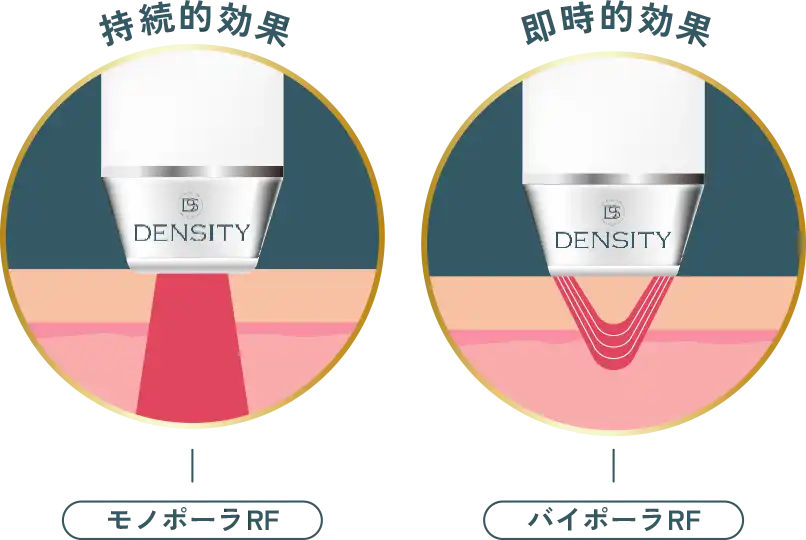 モノポーラRF(深層)とバイポーラRF(浅層)